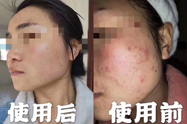 精油能喝嗎？不是所有精油都能喝-歐泉生化